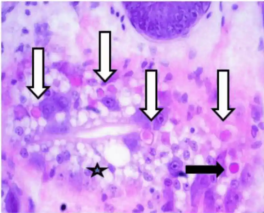 hepatopankreas juvenile udang terserang mbv